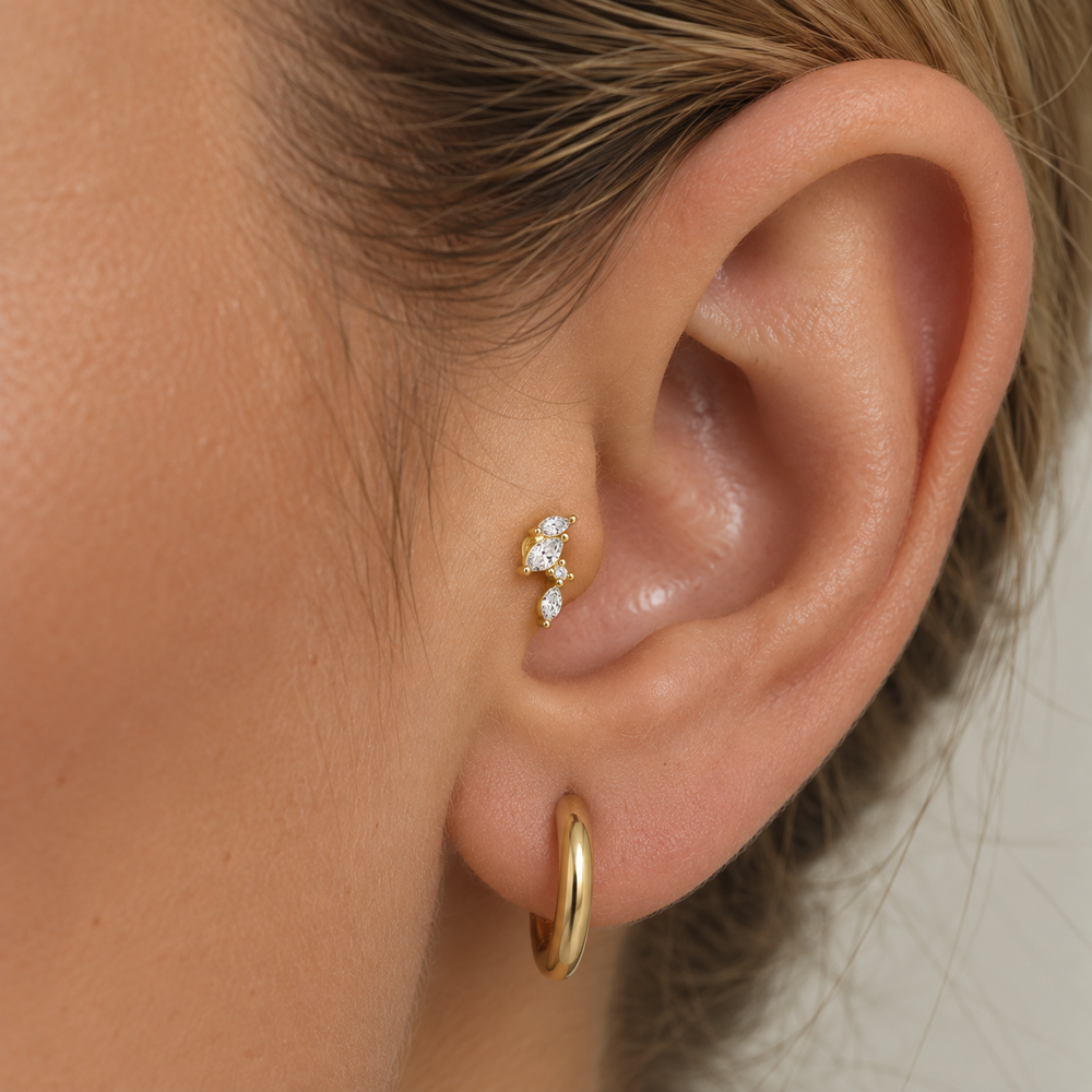 Overa Tragus
